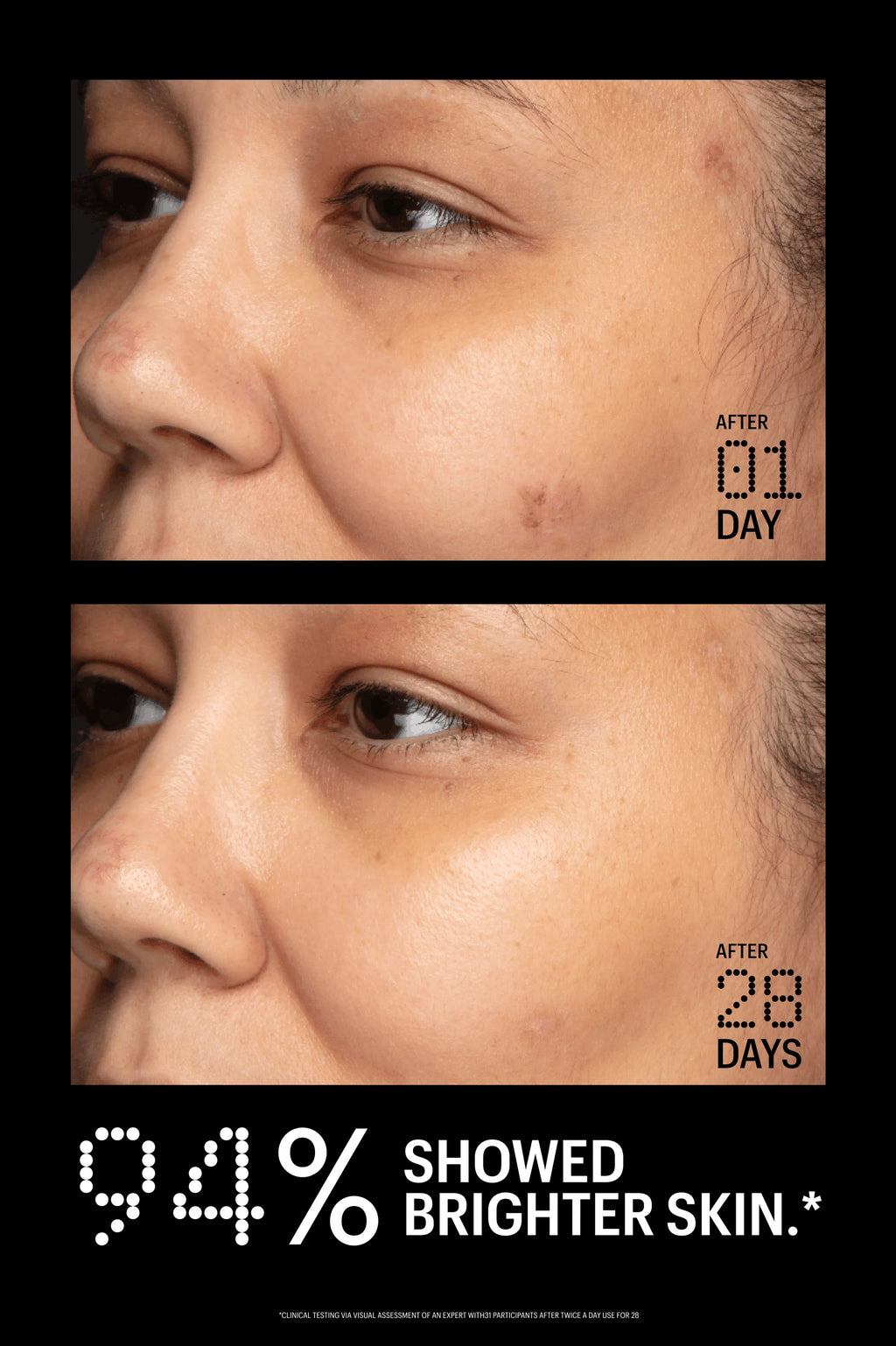 Allies of Skin Azelaic & Kojic Advanced Clarifying Serum