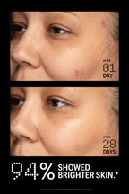 Allies of Skin Azelaic & Kojic Advanced Clarifying Serum