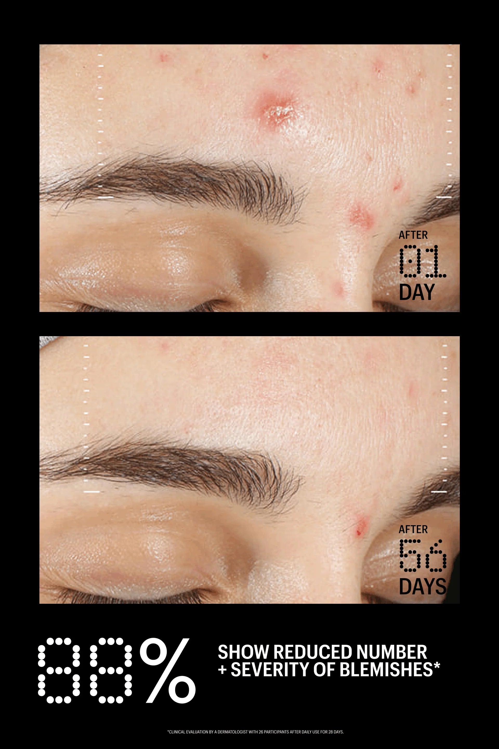 Allies of Skin Azelaic & Kojic Advanced Clarifying Serum