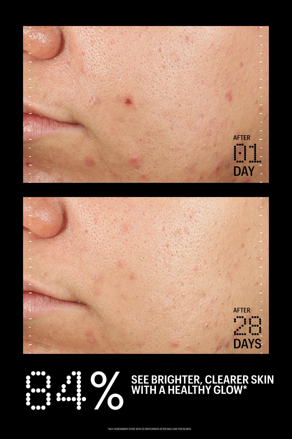 Allies of Skin Azelaic & Kojic Advanced Clarifying Serum