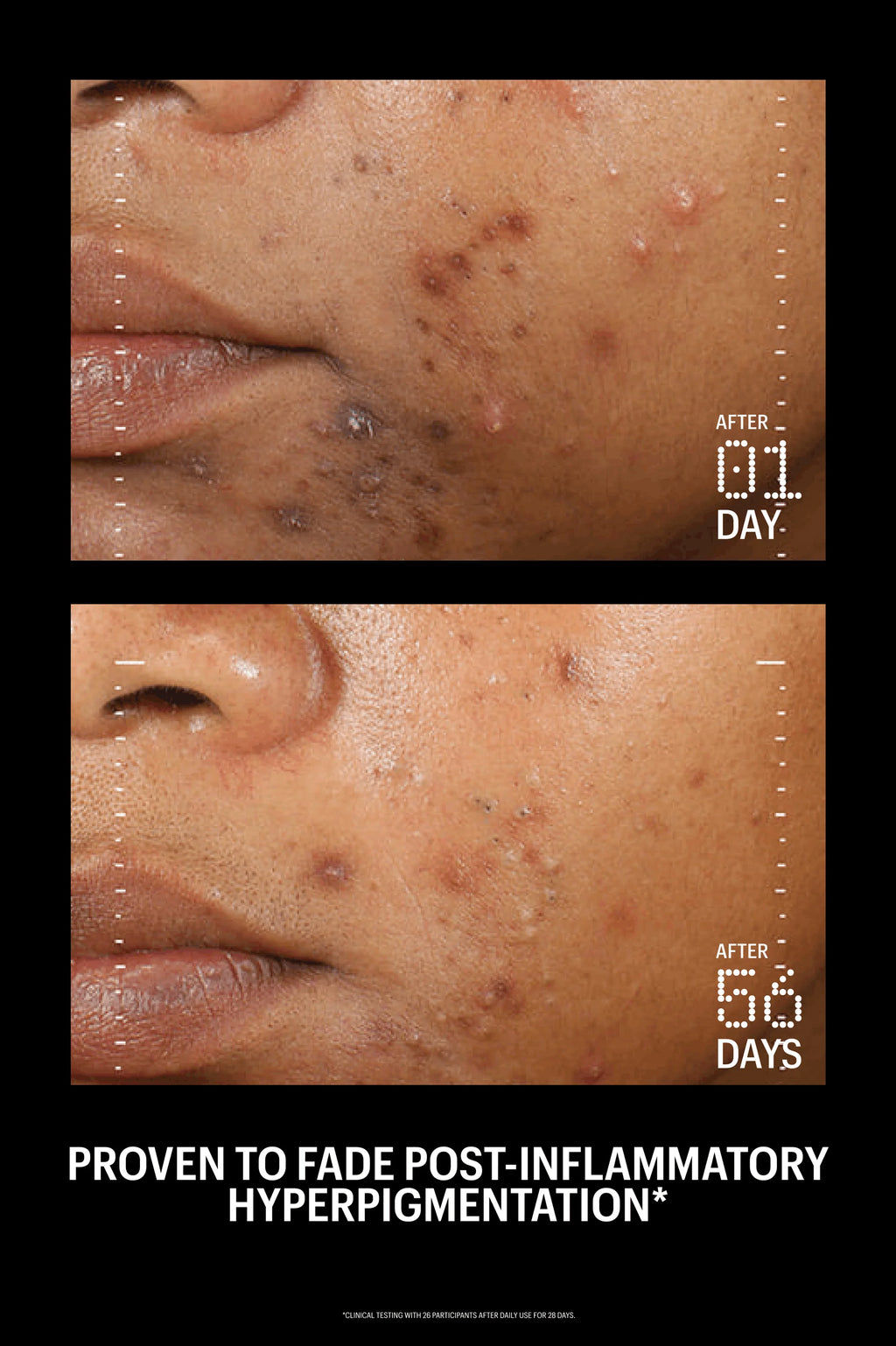 Allies of Skin Azelaic & Kojic Advanced Clarifying Serum