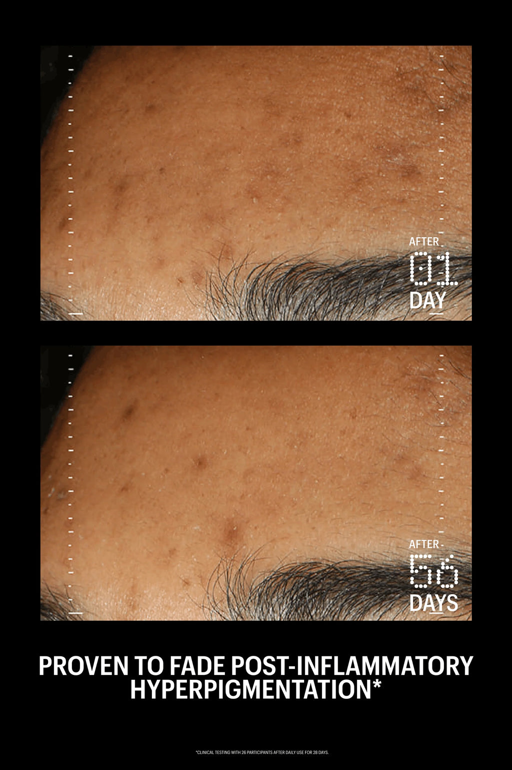 Allies of Skin Azelaic & Kojic Advanced Clarifying Serum