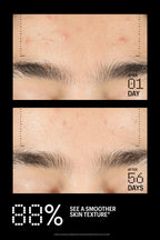 Allies of Skin Azelaic & Kojic Advanced Clarifying Serum