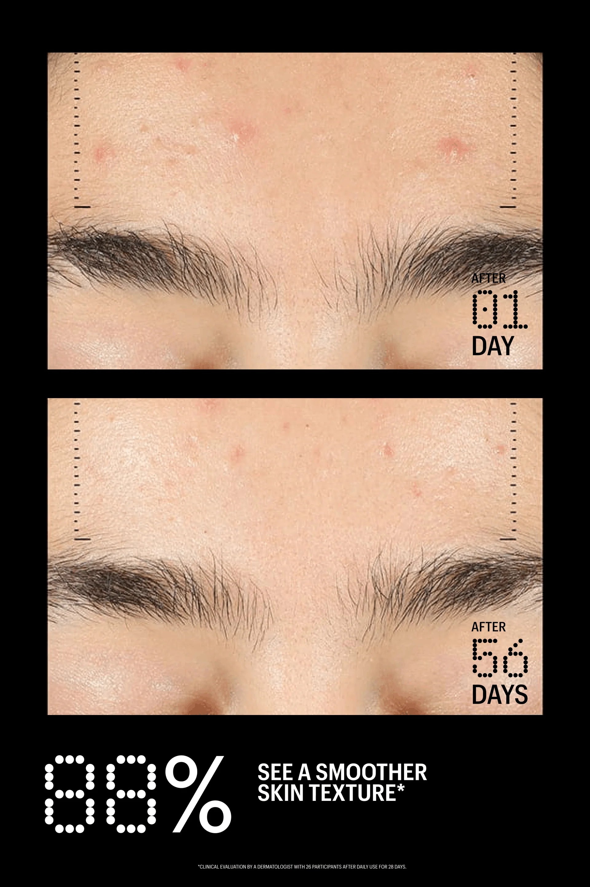Allies of Skin Azelaic & Kojic Advanced Clarifying Serum