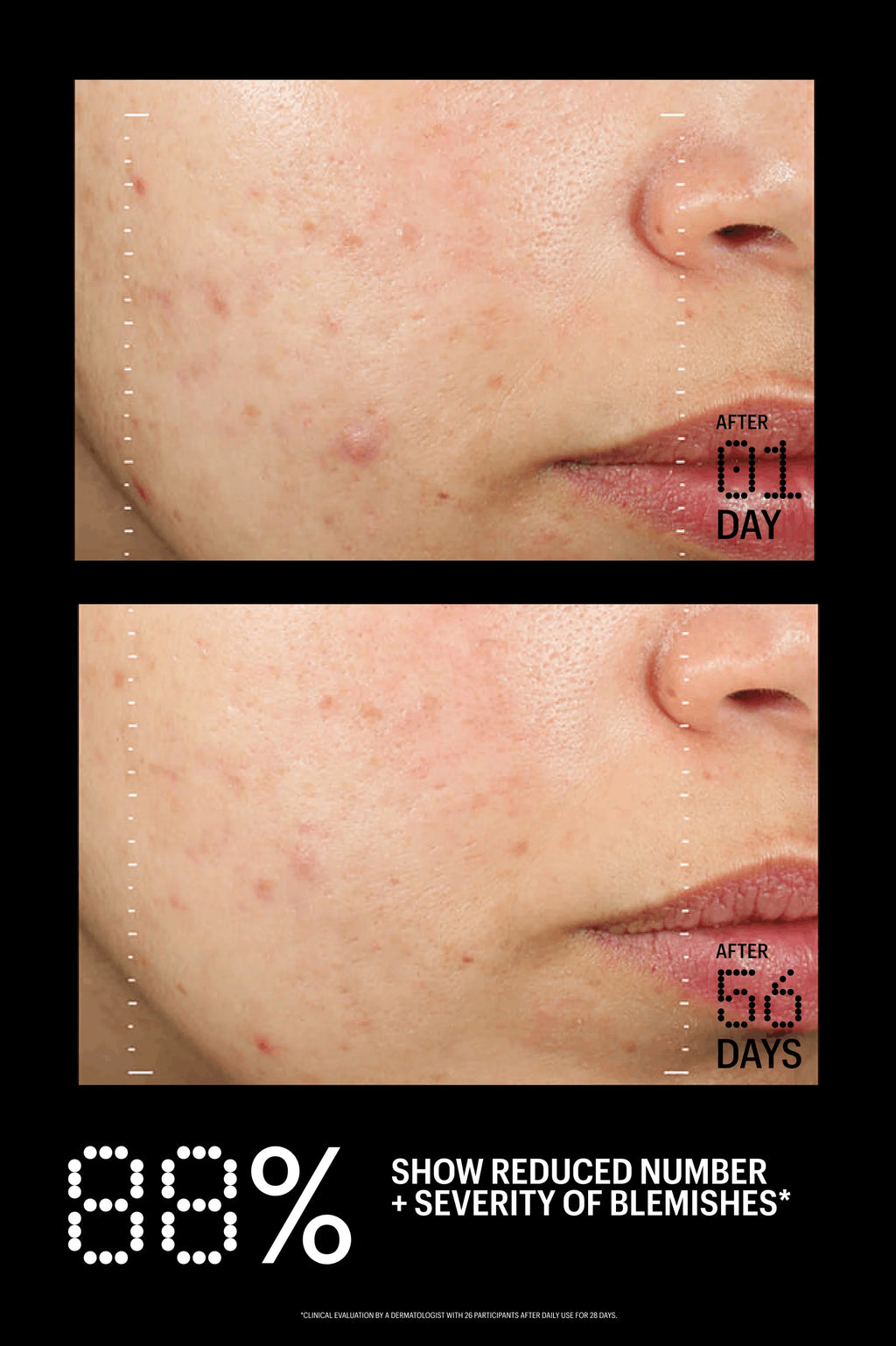 Allies of Skin Azelaic & Kojic Advanced Clarifying Serum