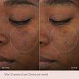 Mz Skin Micro-Peeling Glow Essence