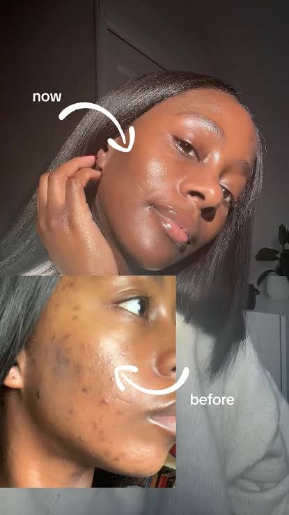 Hue SUPRA-FADE Dark Spot Night Serum