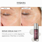 111 Skin Repair Serum NAC Y²™30ml