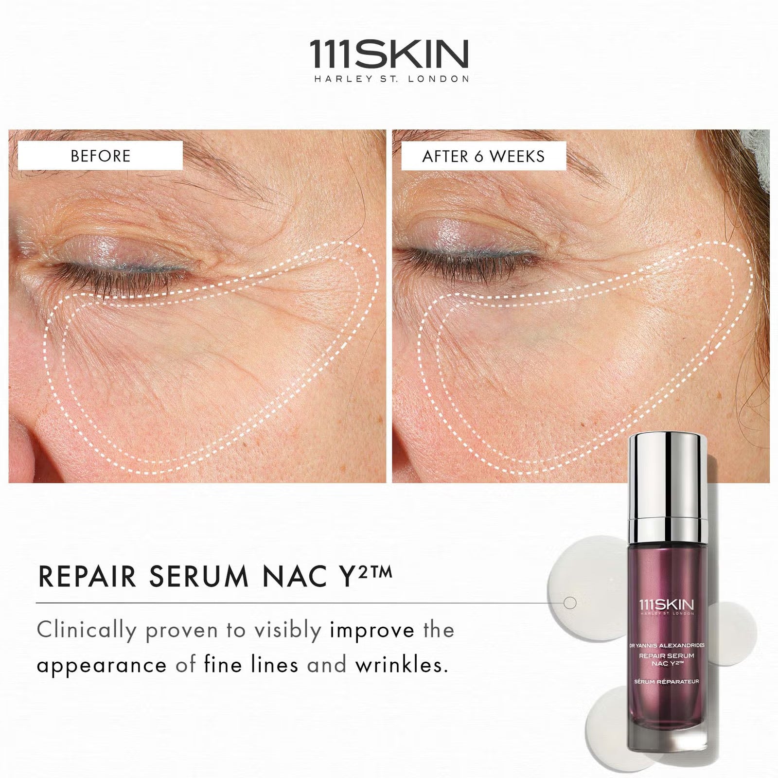 111 Skin Repair Serum NAC Y²™30ml